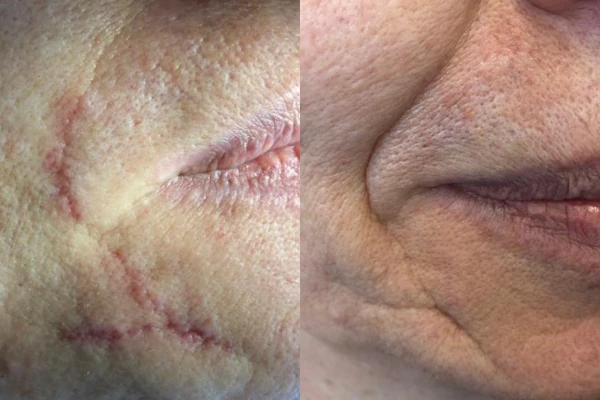 Facial skin condition